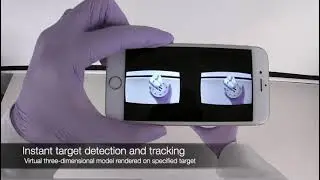 AR dental application