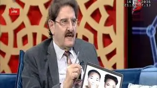 د. حرب العمري استشاري الجلدية  على برنامج مستشارك الصحي عن #ألبهاق الجزء الاول