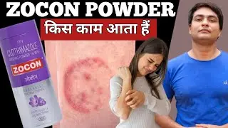 zocon powder | zocon powder uses in hindi | zocon powder for babies | zocon powder uses
