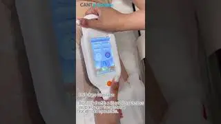 Chill to Sculpt: Advanced Cryotherapy Machine Handles🧊