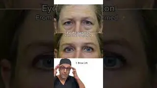 From Baggy to BRIGHT Eyes
