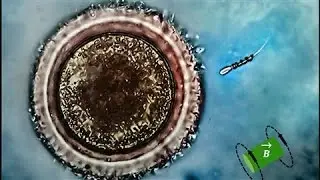 Motorized 'Spermbots' Could Solve Male Infertility