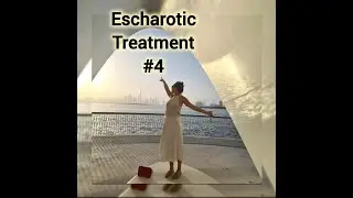 ESCHAROTIC TREATMENT # 4: Herbal mixture for HPV, Warts & Dr Nick Le Roy - CERVICAL DYSPLASIA