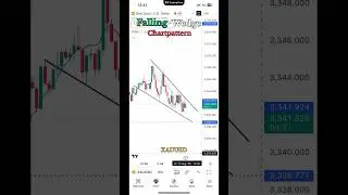 Falling Wedge Breakout 🚀 | XAUUSD 5M Chart | Gold Price Action Live 📈💰