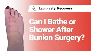 Can I Bathe Or Shower After Bunion Surgery? | Lapiplasty&reg; Recovery