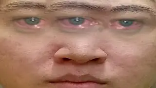 ខ្ញុំខ្សោយណាស់