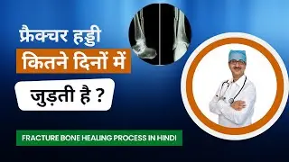 Fracture Bone Healing Process in Hindi | फ्रैक्चर हड्डी कितने दिनों में जुड़ती है ? Dr Rameshwar sir