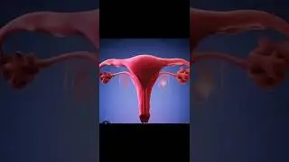 Abnormal Vaginal Bleeding 