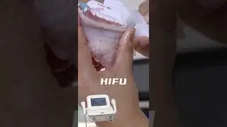 7d HIFU Anti-wrinkle anti-aging machine  #hifu
