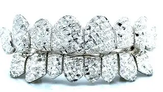 Diamond dust grillz are a #1 request at Seattle Gold Grills