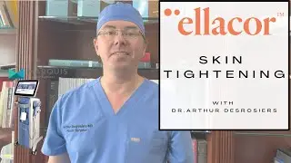 Skin Tightening --  ELLACOR Device --  Micro-Coring