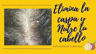 Elimina la |CASPA Y SEBORREA| con la CEBOLLA Y MELAZA#amodomio#adaespinosa#eliminarlacaspa