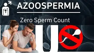 Azoospermia Treatment in Pakistan | Azoospermia Ka Ilaj | Zero Sperm Count Symptoms | Infertility
