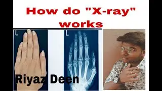 How did X-rays works|Who invented x-rays|Tamil|Riyaz Deen