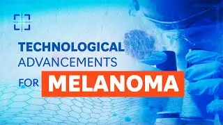 Melanoma Technological Advancements