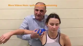Dry Needling for the Deltoid