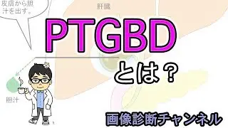 医療用語のPTGBD,PTGBAとは？図を用いてわかりやすく解説！