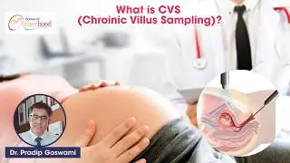Chorionic Villus Sampling (CVS): What It Is And Why It&rsquo;s Done? By Dr. Pradip Goswami
