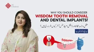 Why You should Consider Wisdom Tooth Extraction and Dental Implants | Maxillofacial Surgeon in ISB