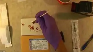 Collecting and Packaging Dried Bloodstain - short version