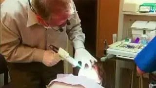 Porcelain Veneers - Cosmetic Dentistry in Edmonton, Alberta