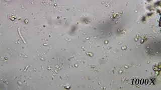 Bacteria Under The Microscope