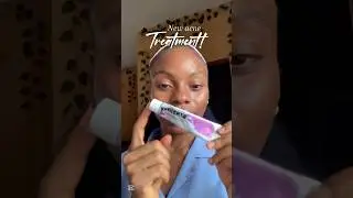 Trying out a new acne treatment