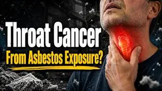 Can Asbestos Exposure Cause Throat Cancer?