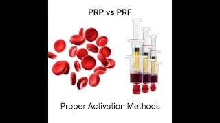 PRP/PRF Preparation  - To activate or not