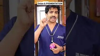 How Onion Helps to Cure PIGMENTATION ? #melasmatreatment #pigmentation #skincare #trending #viral