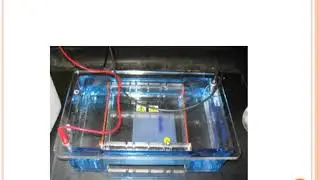 Serum protein electrophoresis