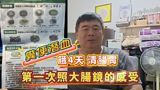 糞便潛血，餓4天清腸胃，第一次照大腸鏡的感受#糞便潛血#大腸鏡#息肉#就醫感受
