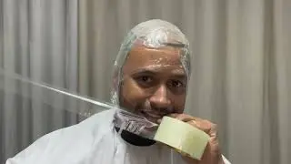 Como fazer o molde da pr&oacute;tese com papel filme