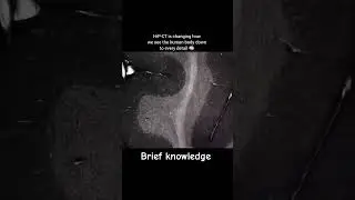 HiP-CT Brain Imaging  | Clearest Brain Ever Seen | This Technology Sees the Brain Like Never Before