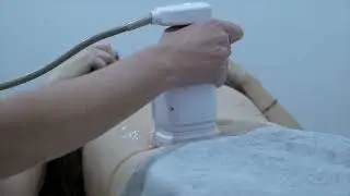 Liposonix en Abdomen en Sevilla