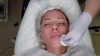 Этапы процедуры VEDARA MEDICAL