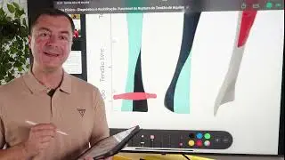 Ruptura do tend&atilde;o de Aquiles em pessoas de alta demanda