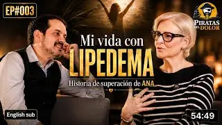 LIPEDEMA ¿Qué es? EP#003 Historia de lipedema contada en primera persona. #dolor #lipedema #lipedema