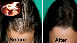 Extreme THICk HAIR for all age group/മുത്തശ്ശിയുടെ Secret Tip/ചിരട്ടക്കരി വീട്ടിൽ ഉണ്ടാക്കാം.