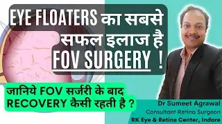 EYE FLOATERS हटाने की SURGERY ( FOV SURGERY ) के बाद RECOVERY में कितना TIME लगता है ?