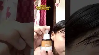✨ Dermatouch Bye Bye Pigmentation Serum #viral #skincare #trending #beauty #glowingskin #shorts#bome
