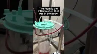 This is how celebrities stay young. 💉