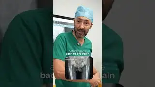 Hip replacement in Dubai