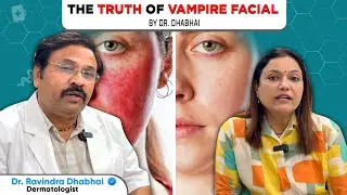 Vampire facial ke fayde, side effects, & cost | full guide.