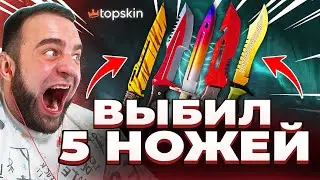 🔥 TOPSKIN ВЫБИЛ 5 НОЖЕЙ в КС ГО - ЭТО ЖЕСТЬ в КС ГО - TOPSKIN ПРОМОКОД