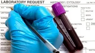 Bad blood test results..