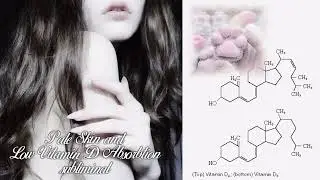 Porcelain Skin | 🐑 | Pale skin and Vitamin D limiting Subliminal | (ug, scientific)
