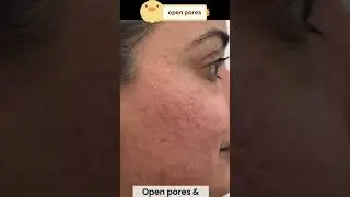 Face की 8 Problems सॉल्व करे सिर्फ 1 product से ❤️#skincare #brightskin #sunscreen #facewash #viral