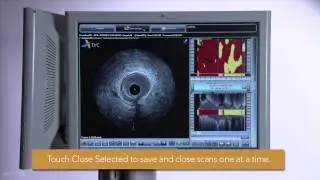Completing a Procedure on the TVC Imaging System
