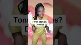How to remove tonsil stones #tonsilstones #badbreathsolutions #shorts